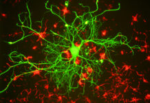 The Failed Quest for Biomarkers in Psychiatry