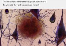 “Their Brains had the Telltale Signs of Alzheimer’s. So why did They Still Have Nimble Minds?”