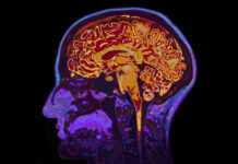 Lancet Psychiatry Needs to Retract the ADHD-Enigma Study