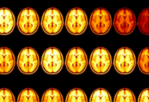 The Man With the Most Famous Brain in Science