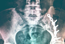 Licensed to Bill: How Doctors Profit From Injury Assessments
