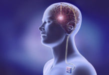 Brain Implants: Spinning the Trial Results to Protect the Product deep brain stimulation