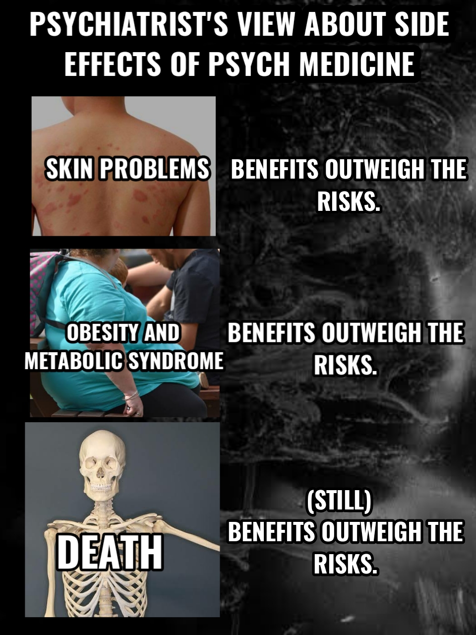 Psychiatrist's view about side effects of psych medicine. Skin problems/Benefits outweigh the risks. Obesity and metabolic syndrome/benefits outweigh the risks. Death/(Still) Benefits outweigh the risks.