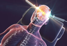 Critical Psychiatry Textbook Chapter 12: Electroshock 3D illustration of anatomic figure lying down with electric shock through its brain