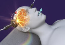 Researchers Give High Safety Rating to ECT Despite 69% Risk of Memory Loss in Adolescents