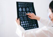 Don’t Give Symptom-Free People Alzheimer’s Drugs