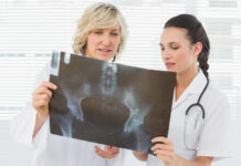 Are Antidepressants Weakening Women’s Bones?
