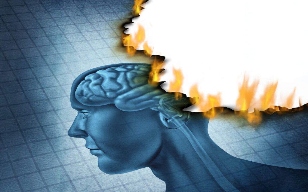 A drawing of a human head, brain visible in profile, being burned