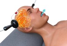 Electroconvulsive therapy (ECT): It’s Not Just the Memory Loss ECT